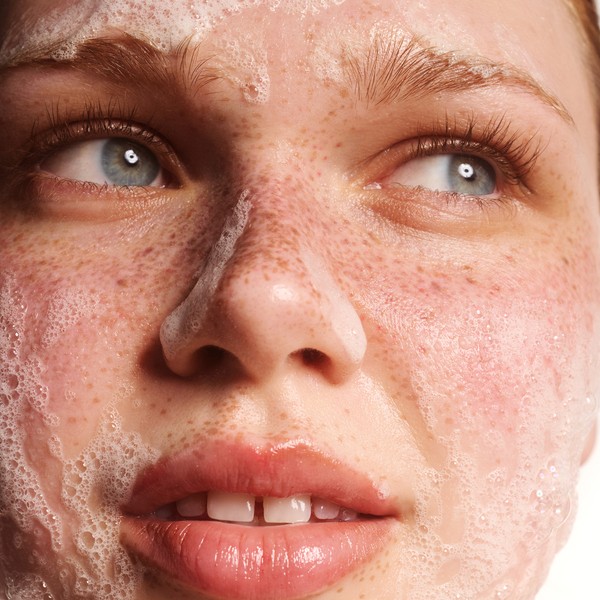 Обличчя Жирна і пошкоджена шкіра